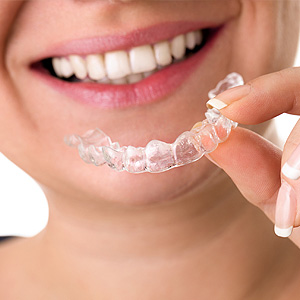 invisalign.