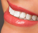 teeth-whitening-smile.jpg