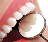 tooth-colored fillings.