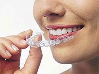 Invisalign orthodontics.