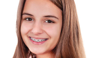 Girl with braces.