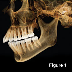 CAT scans in dentistry