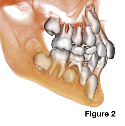 CAT scans in dentistry