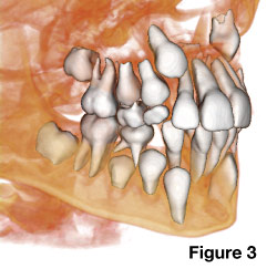 CAT scans in dentistry