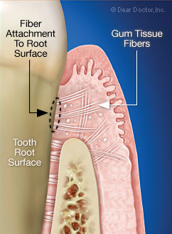 Gum tissue fibers are attached to the tooth root surface