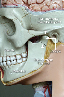 Hasil gambar untuk subluxation jaw joint