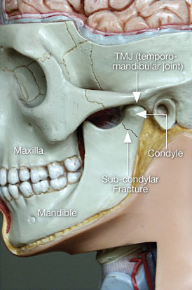 Jaw Pain Illustration