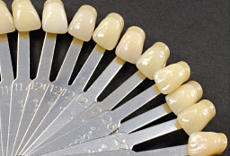 Matching Teeth and Dental Implants - Making dental implant crowns look real