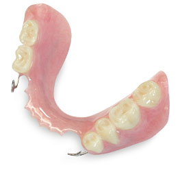 Removable partial denture