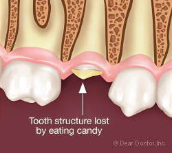 Saving Broken Teeth Dear Doctor Dentistry Oral Health
