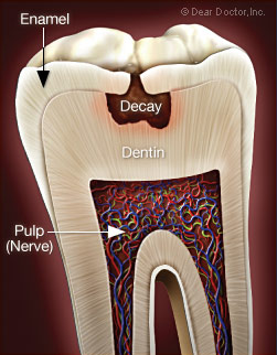 Severe Toothache Illustration