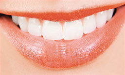 Teeth whitening