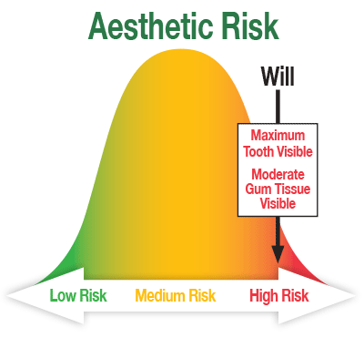Aesthetic risk chart.