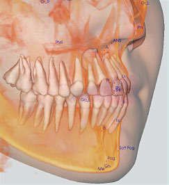 Cat Scan for orthodontics.