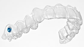 Invisalign colored compliance indicators.