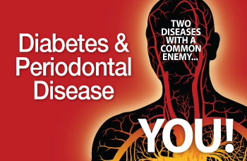 Diabetes and periodontal disease.