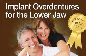 Implant overdentures for the lower jaw.