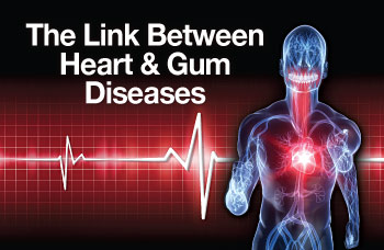 The link between heart and gum diseases.