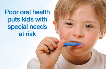 Managing tooth decay chronic diseases.