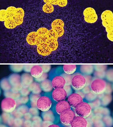 MRSA Superbugs.