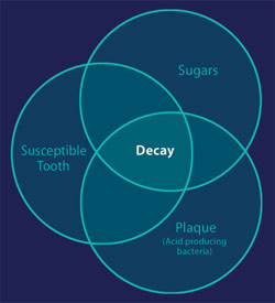 Cause of tooth decay diagram.