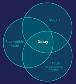 Cause of tooth decay diagram.
