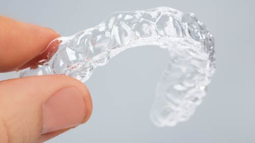 Clear orthodontic aligners.