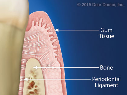 Periodontal ligament.