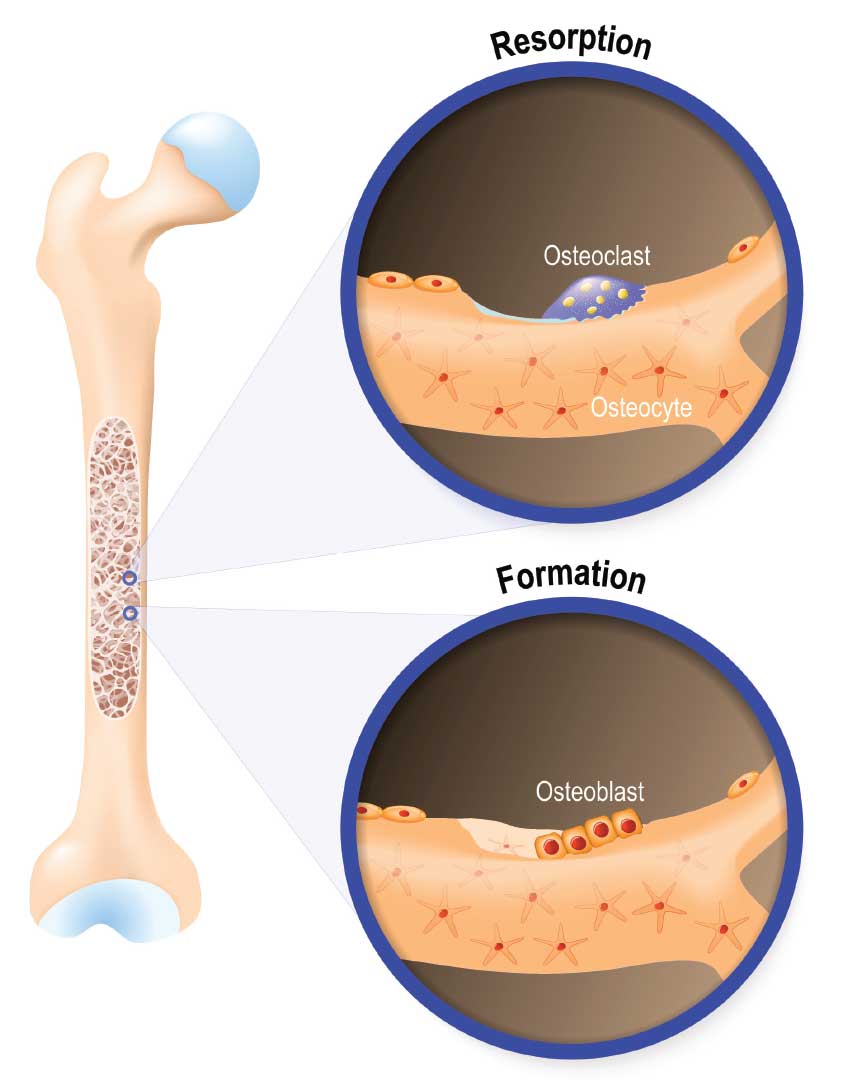 Bone tissue.