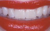 Figure 12.