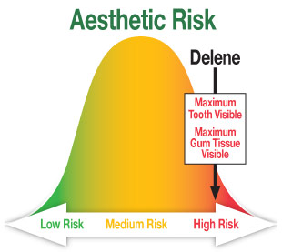 Aesthetic Risk.