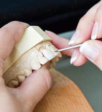 Creating Porcelain Veneers