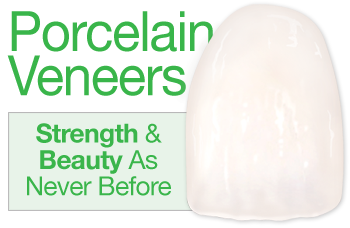 Porcelain Veneers.