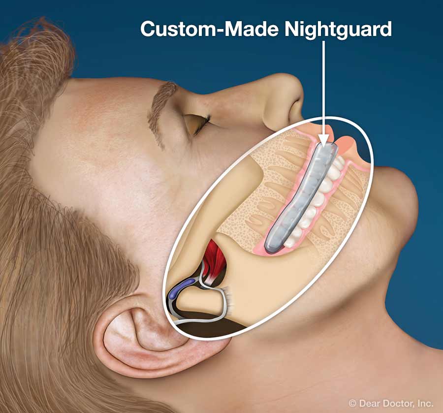 Referred Pain