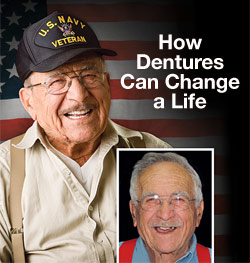 Denture before and after