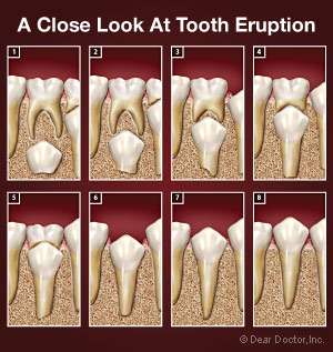 Tooth eruption process