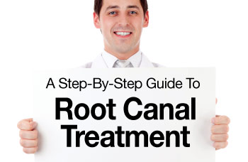Root canal treatment step by step.