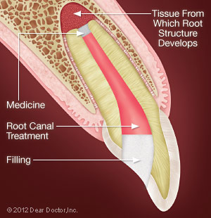 Medicine - Specialized Bio-materials Promote Successful Healing.