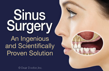 Sinus surgery and dental implants.