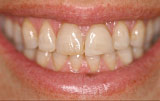 Original smile - Figure 8.