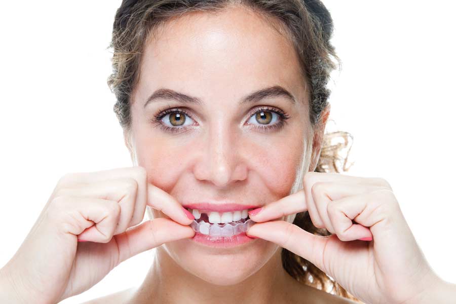 Straightening a smile with clear aligners.