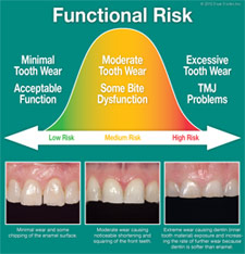 Functional Risk.