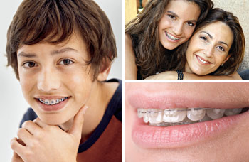 The magic of orthodontics.