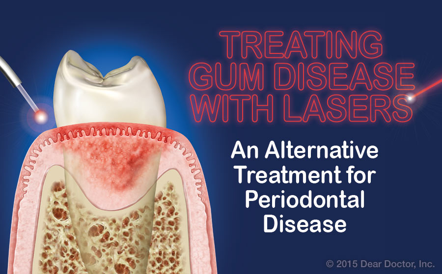 Treating gum disease with lasers.