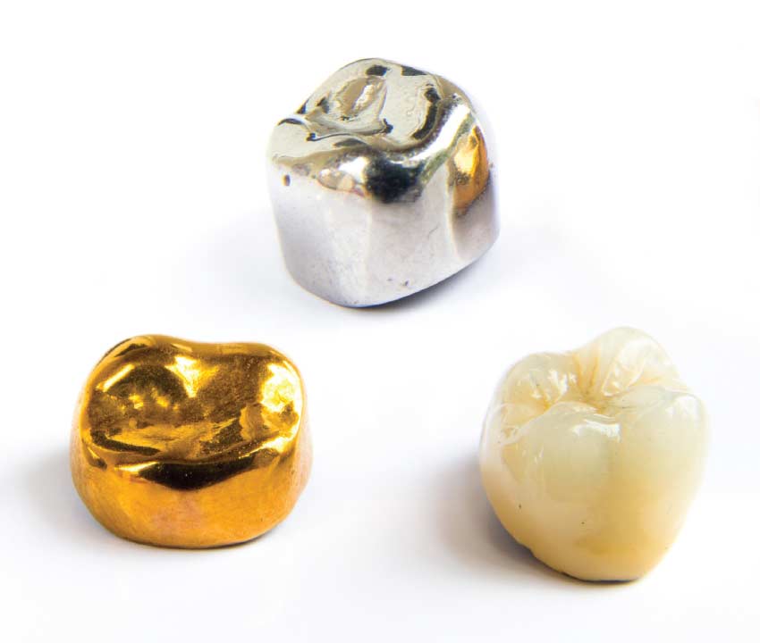 Dental crown materials.