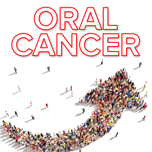 Oral Cancer in Men Caused by Sexually Transmitted Virus Is on the Rise