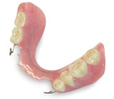 Understanding the Role of Removable Partial Dentures