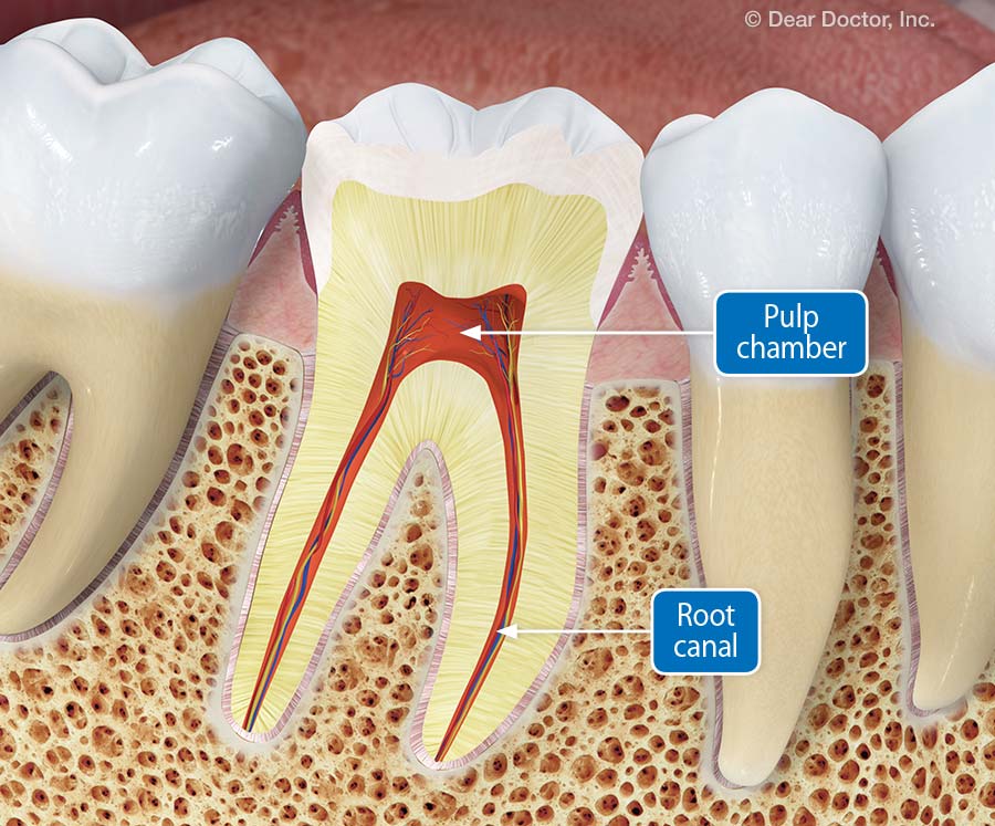 front tooth root canal