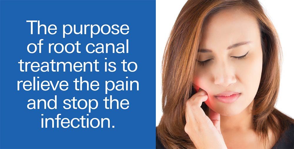 Root canal treatment.