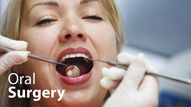 Oral Surgery Video